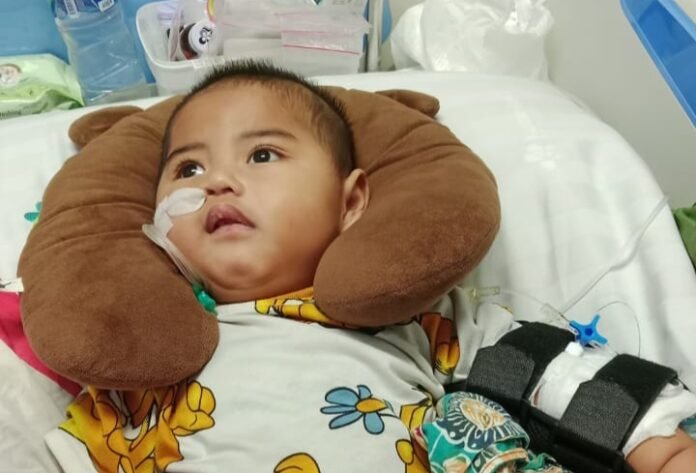 Balita di Ciamis Terbaring Lemah Melawan Epilepsi Langka, Keluarga Menanti Uluran Tangan Pemerintah